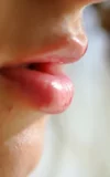 ST18_RAKEL_U_RAKEL_-_CLOSE_UP_TO_MY_BODY_15.webp